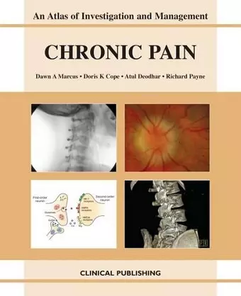 Chronic Pain cover