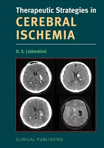 Cerebral Ischemia cover