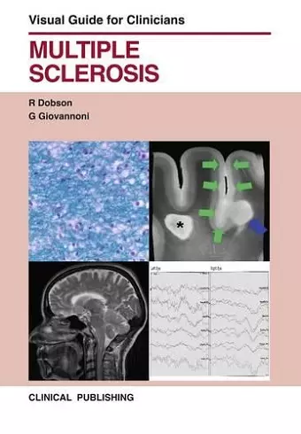 Multiple Sclerosis cover