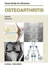 Osteoarthritis cover