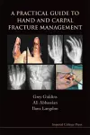 Practical Guide To Hand And Carpal Fracture Management, A cover