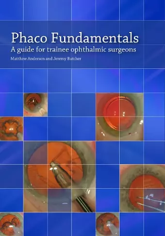 Phaco Fundamentals cover