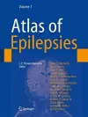 Atlas of Epilepsies cover