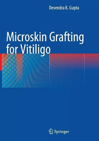 Microskin Grafting for Vitiligo cover