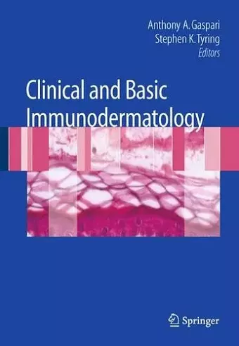 Clinical and Basic Immunodermatology cover