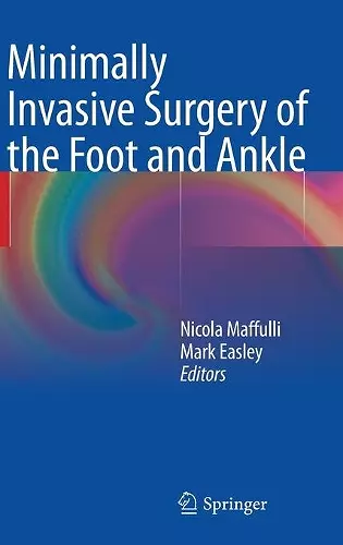 Minimally Invasive Surgery of the Foot and Ankle cover