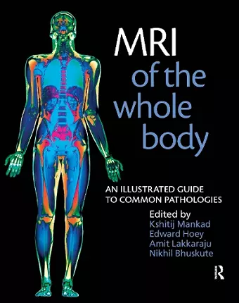 MRI of the Whole Body cover