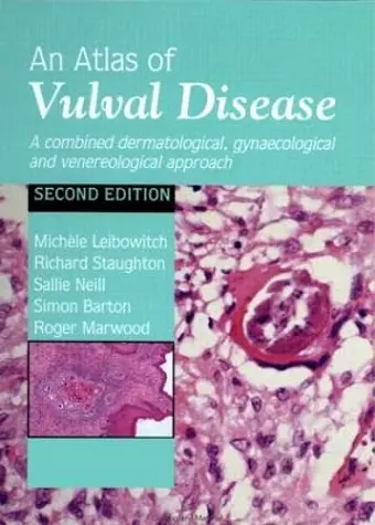 An Atlas of Vulval Diseases cover