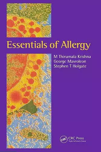 Essentials of Allergy cover