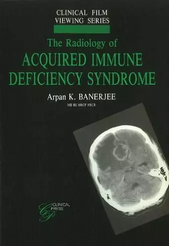 Radiology of Acquired Immune Deficiency Syndrome cover