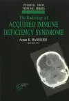 Radiology of Acquired Immune Deficiency Syndrome cover