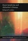 Down Syndrome and Alzheimer's Disease cover