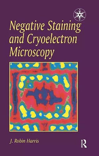 Negative Staining and Cryoelectron Microscopy cover