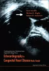 Echocardiography In Congenital Heart Disease Made Simple cover