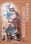 Surgical Complications: Diagnosis And Treatment cover