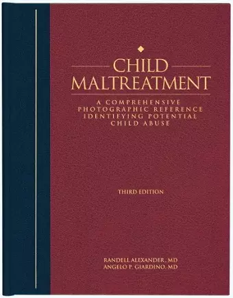 Child Maltreatment cover