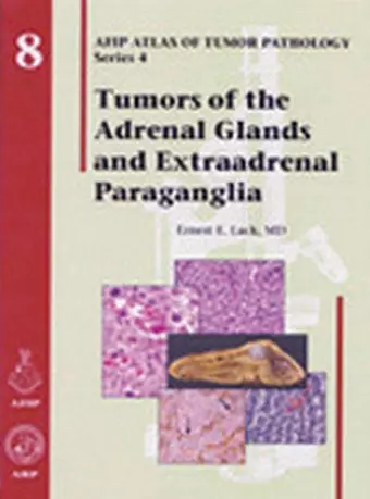 Tumors of the Adrenal Glands and Extraadrenal Paraganglia cover