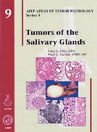 Tumors of the Salivary Glands cover