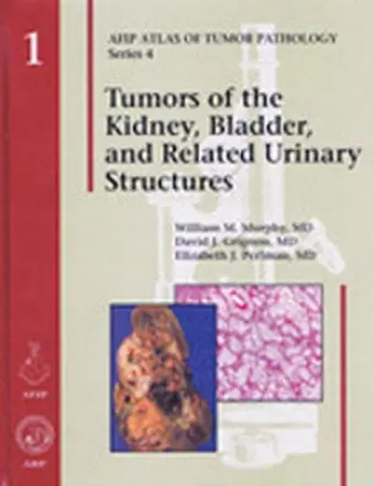 Tumors of the Kidney, Bladder, and Related Urinary Structures cover