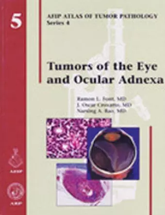 Tumors of the Eye and Ocular Adnexa cover