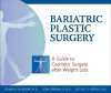 Bariatric Plastic Surgery cover