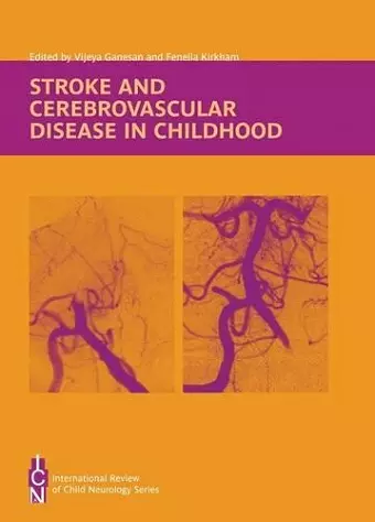 Stroke and Cerebrovascular Disease in Childhood cover