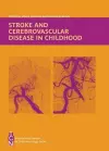 Stroke and Cerebrovascular Disease in Childhood cover