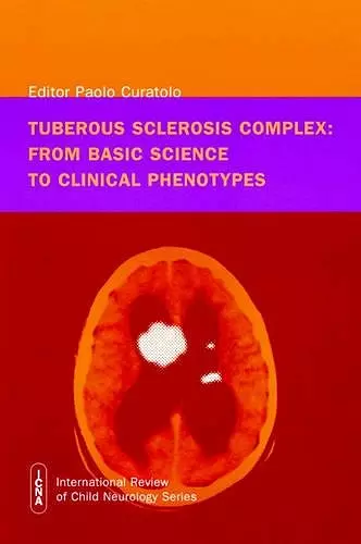 Tuberous Sclerosis Complex cover