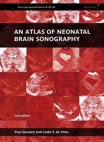 An Atlas of Neonatal Brain Sonography cover