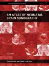 An Atlas of Neonatal Brain Sonography cover