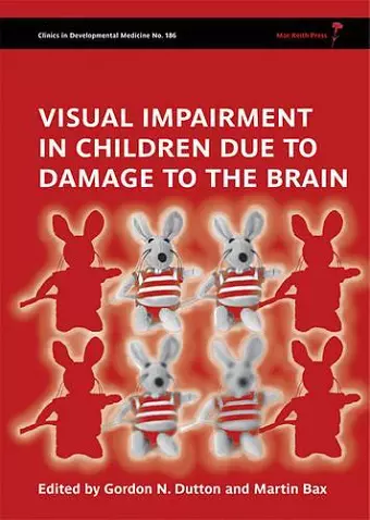 Visual Impairment in Children due to Damage to the Brain cover