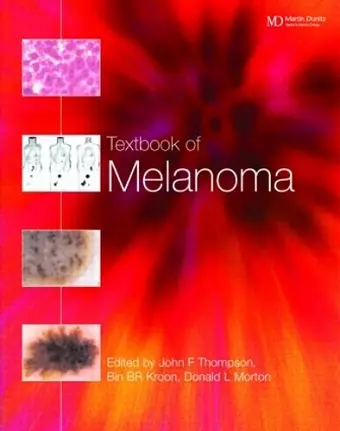 Textbook of Melanoma cover