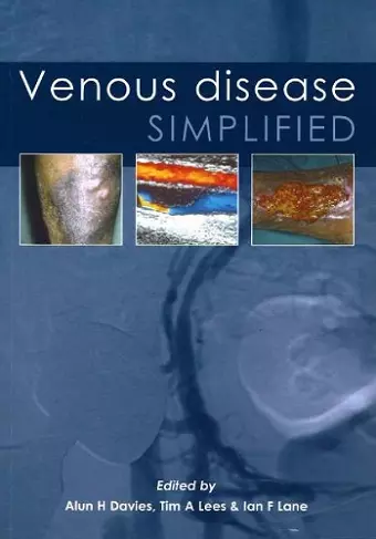 Venous Disease Simplified cover