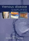 Venous Disease Simplified cover