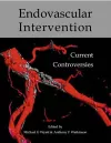 Endovascular intervention cover