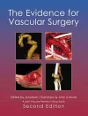 The Evidence for Vascular Surgery; second edition cover
