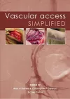 Vascular Access Simplified; second edition cover