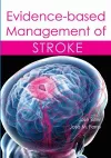 Evidence-based Management of Stroke cover