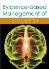 Evidence-based Management of Epilepsy cover