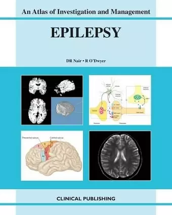 Epilepsy cover