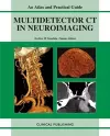 Multidetector CT in Neuroimaging cover