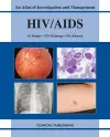 HIV/AIDS cover