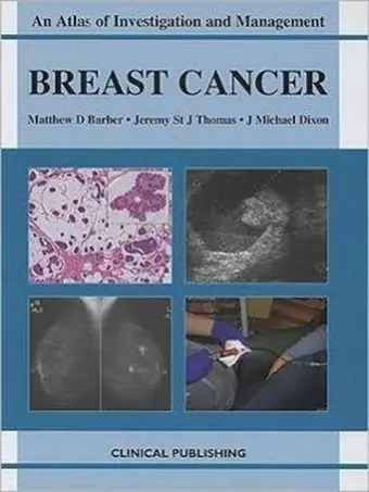 Breast Cancer cover