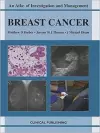 Breast Cancer cover