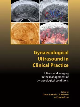 Gynaecological Ultrasound in Clinical Practice cover