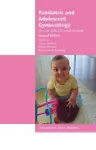 Paediatric and Adolescent Gynaecology for the MRCOG and Beyond cover