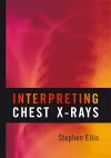 Interpreting Chest X-Rays cover