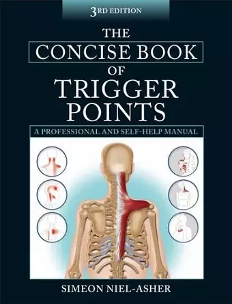 The Concise Book of Trigger Points cover