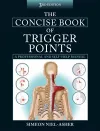 The Concise Book of Trigger Points cover
