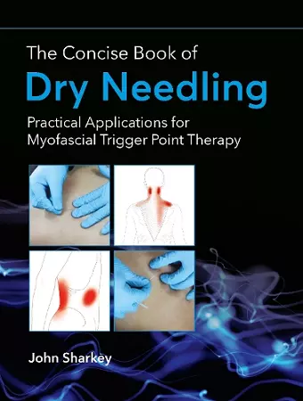 The Concise Book of Dry Needling cover